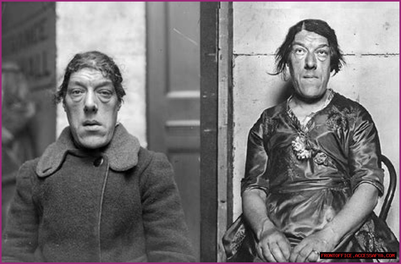 The Surprising Truth About Being Dubbed The Ugliest Person In The World